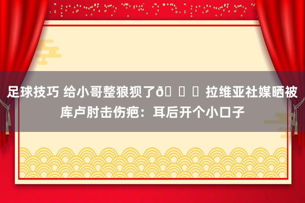 足球技巧 给小哥整狼狈了😅拉维亚社媒晒被库卢肘击伤疤：耳后开个小口子