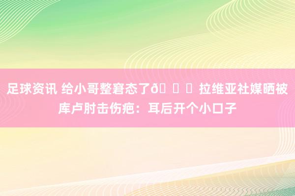 足球资讯 给小哥整窘态了😅拉维亚社媒晒被库卢肘击伤疤：耳后开个小口子